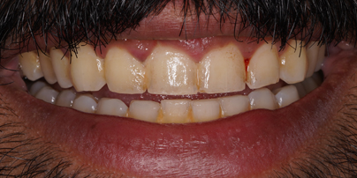 Before - Crook Log Dental Practice