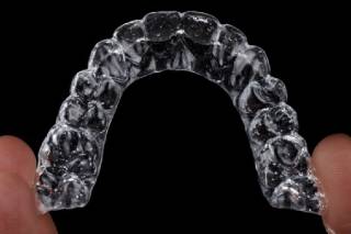 invisalign clear aligners