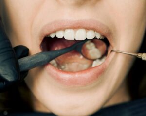 Dental Anxiety check up